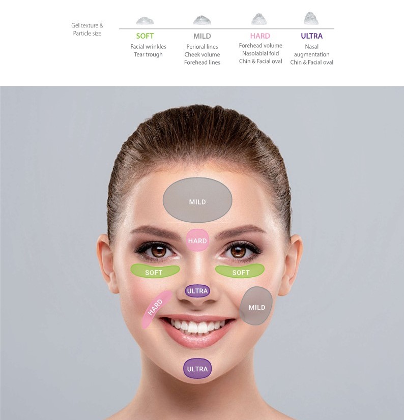 CARA facial treatment zones