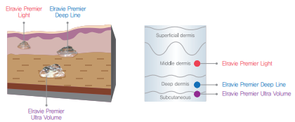 Elravie Premier injection depth